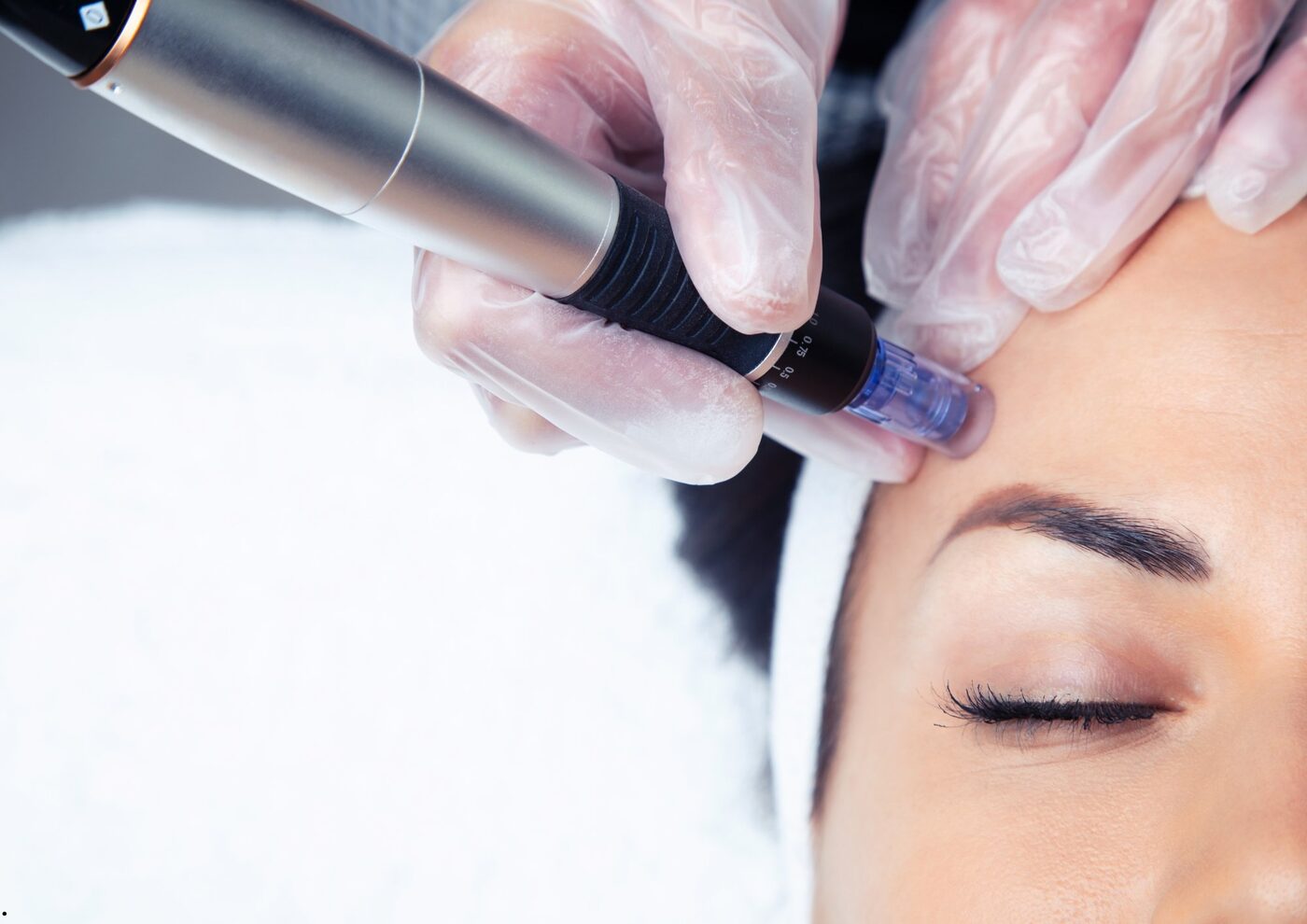 Fresh, healthy-looking skin after a regenerative treatment